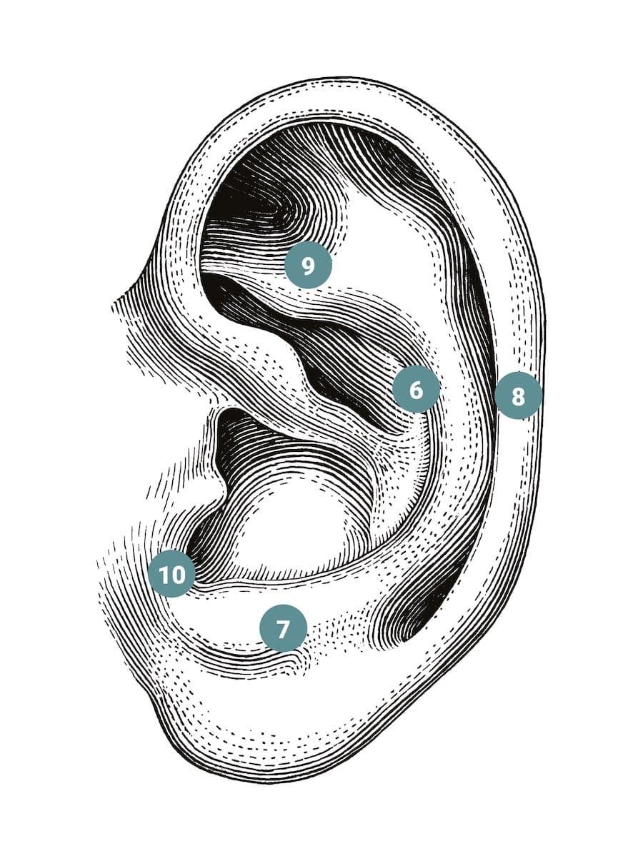 Piercingpunktur-Punkte 6-10