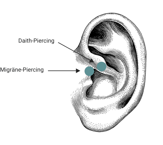 Migräne-piercing vs. Daith-Piercing