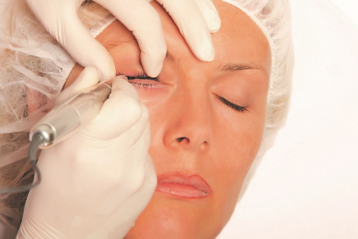 Wimpernkranzverdichtung