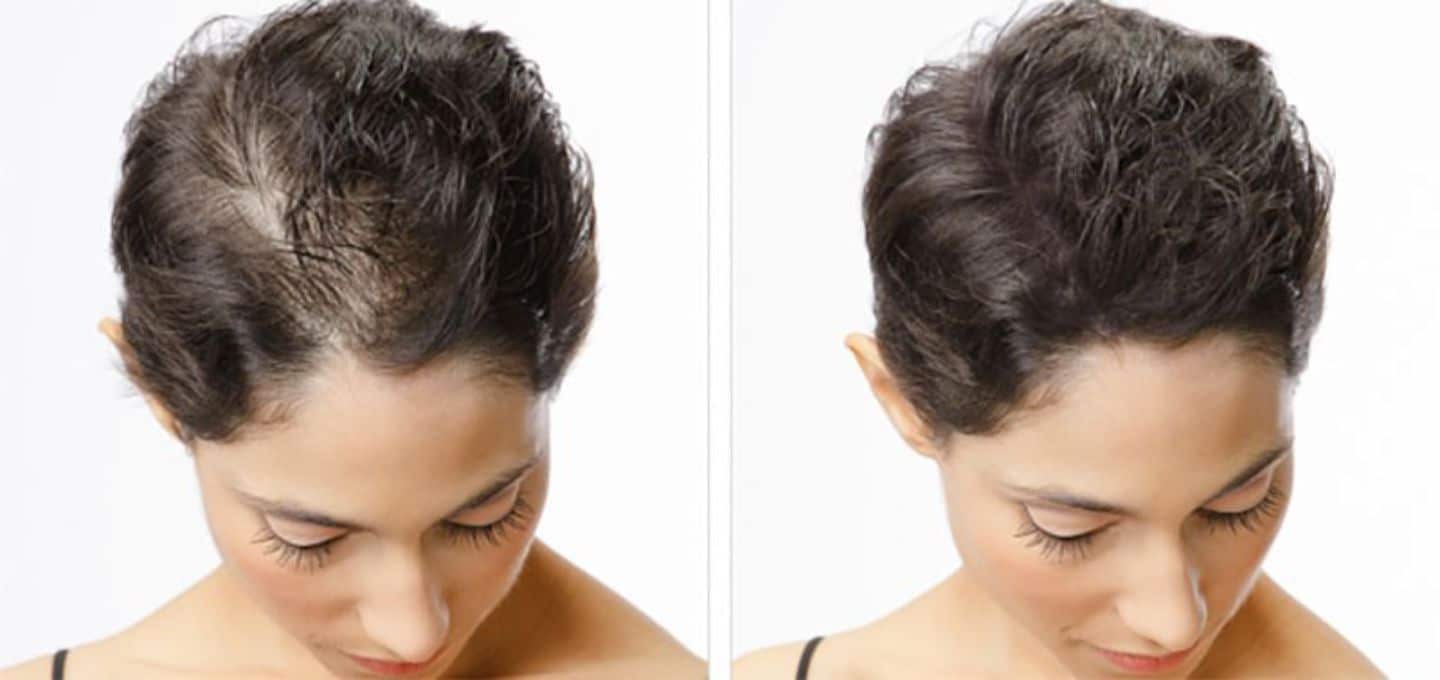 Permanet-Make-up-Kopfhaut