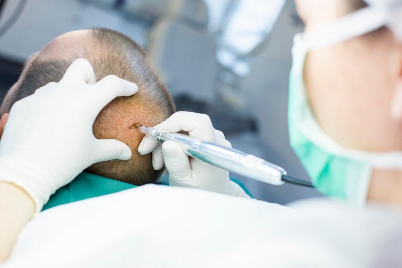 Optische Haarbodenverdichtung