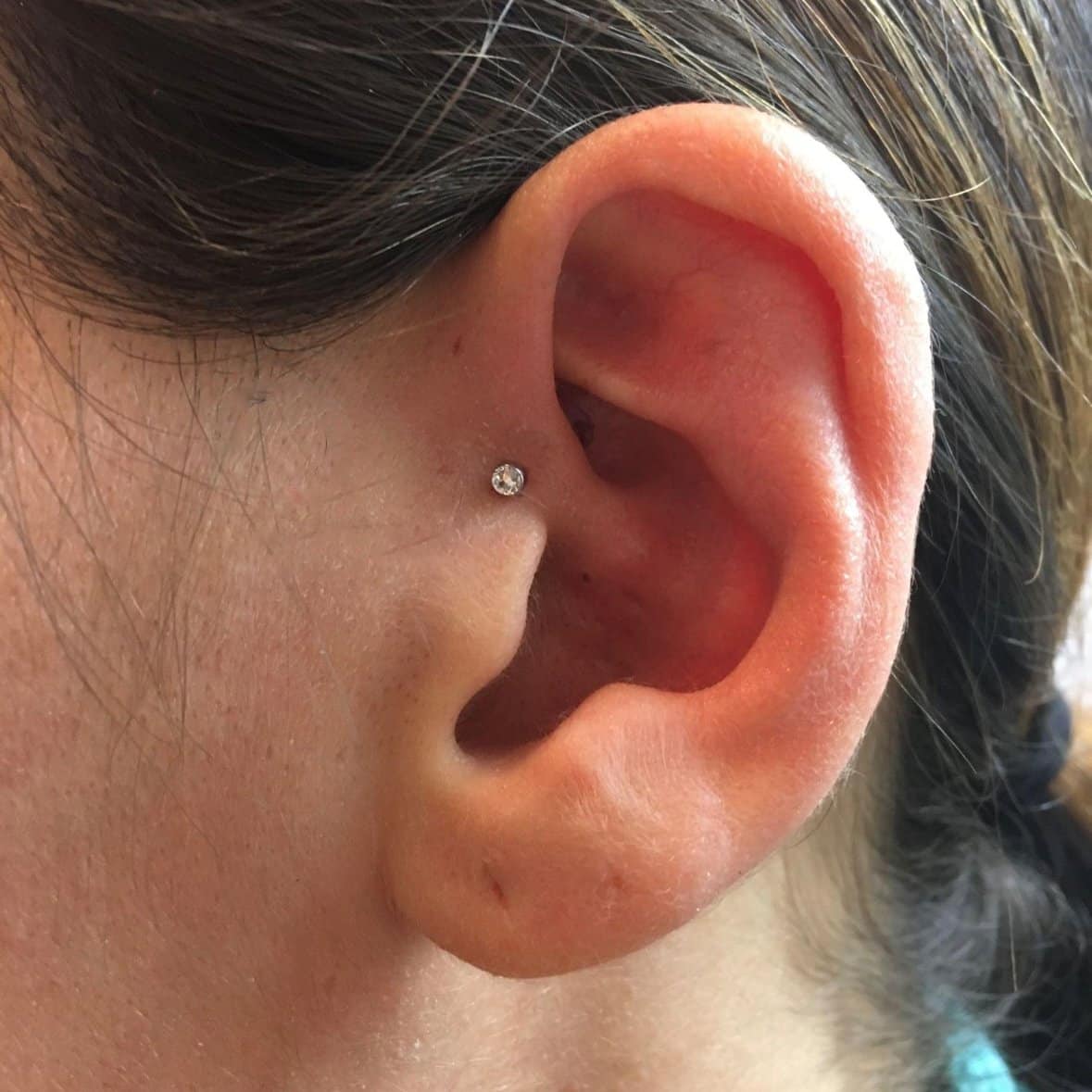 Migräne-Piercing
