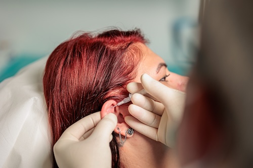 Piercingpunktur